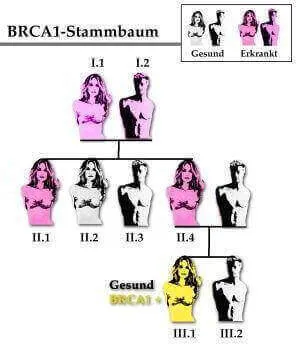 BRCA1 Stammbaum
